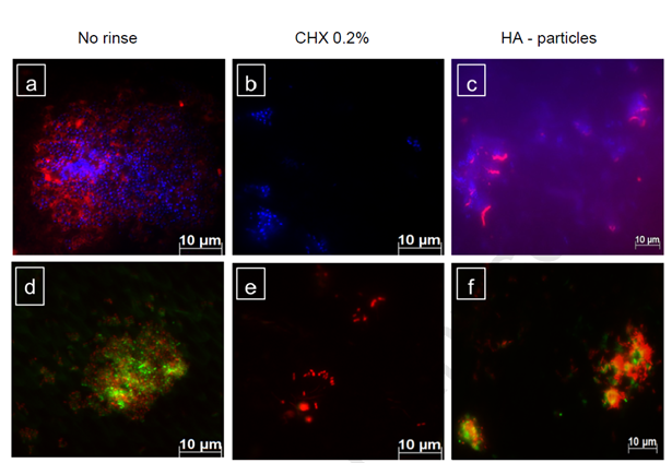 флоуресцентное микроскопическое исследование.png